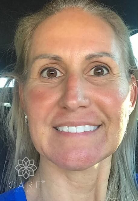 Facial Esthetics After 2