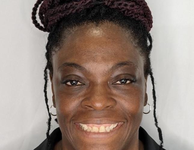 Invisalign and Gum Lift Before