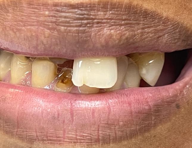 Upper Bridge 8 Before