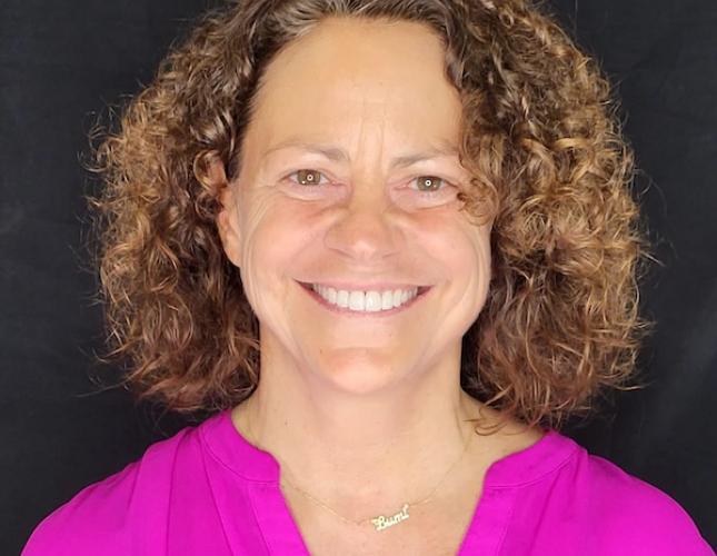 Invisalign and Veneers After