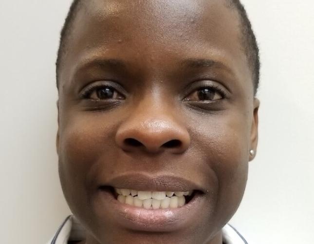 Six Month Smile 4 Before