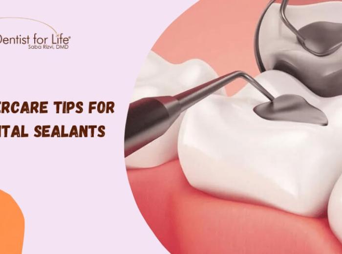 4 Aftercare Tips For Dental Sealants