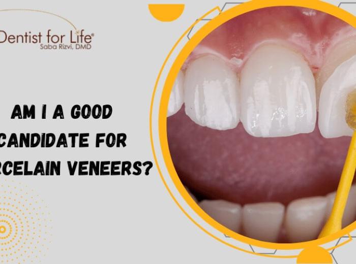 Am I a Good Candidate for Porcelain Veneers?