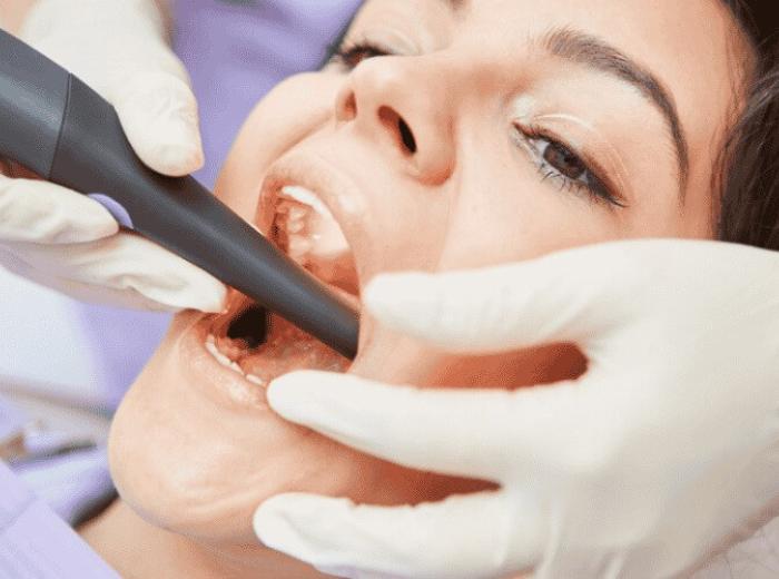 Debunking the Pain Myth: Root Canals Explained