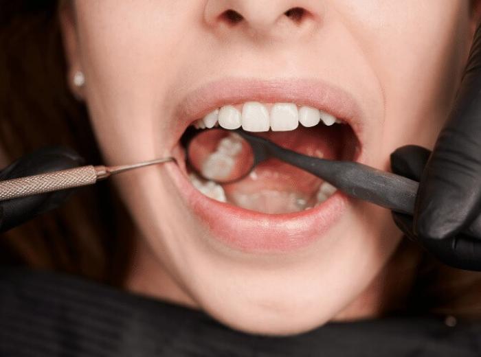 Dental Health Myths Debunked: Separating Fact from Fiction