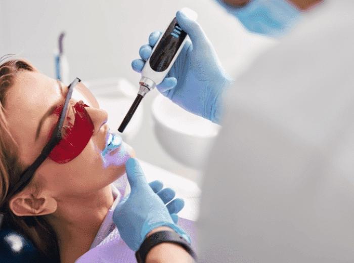When Will Dental Sealants Feel Normal Again? Here’s What to Expect