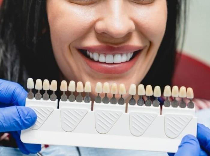 Common Appearance Problems Veneers Can Treat
