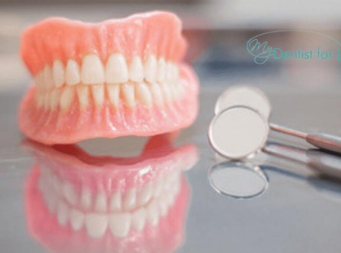Know The Differences Between Full & Partial Dentures