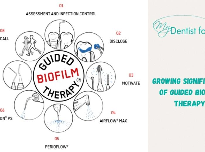 Growing Significance of Guided Biofilm Therapy