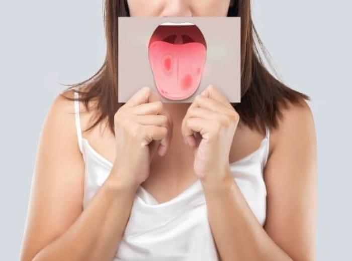 What Your Tongue Says About Your Health: Signs You Shouldn’t Ignore