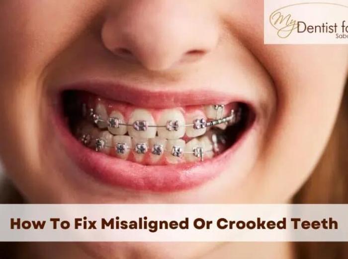 Orthodontics and Sports: How to Protect Your Smile During Summer Activities?