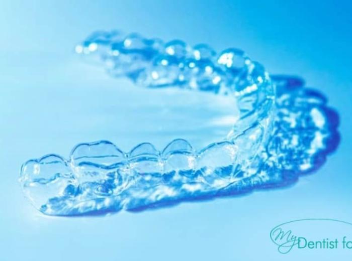Keeping Clear Aligners Clean: A Guide to Proper Care and Maintenance