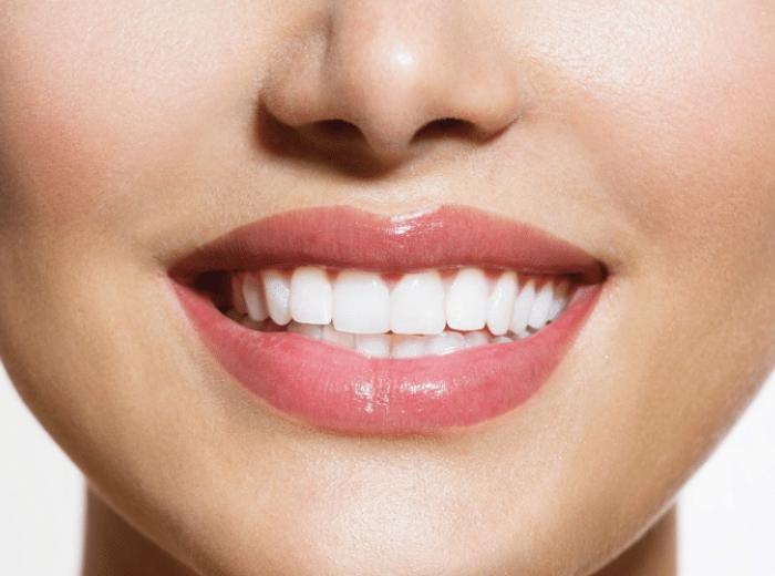 Unhappy with Your Teeth Shade? Kör Whitening Can Help