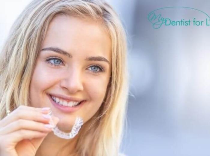 6 Advantages Of Getting Invisalign