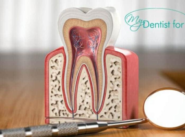 How Long Until The Cavity Becomes A Root Canal?