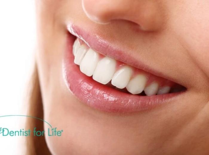 Digital Smile Design – Definition & Benefits