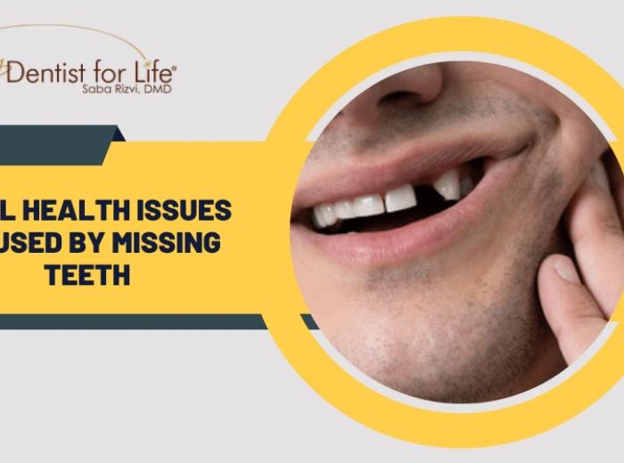 5 Oral Health Issues Caused by Missing Teeth