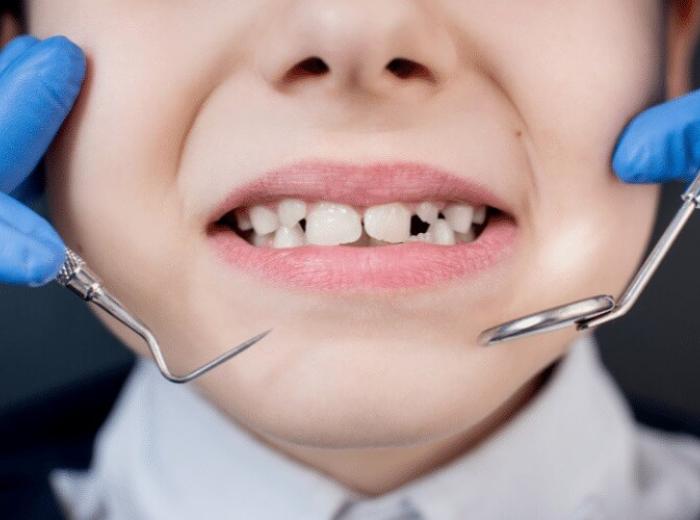 Types of Oral Surgery: Exploring Common Procedures and Their Purposes