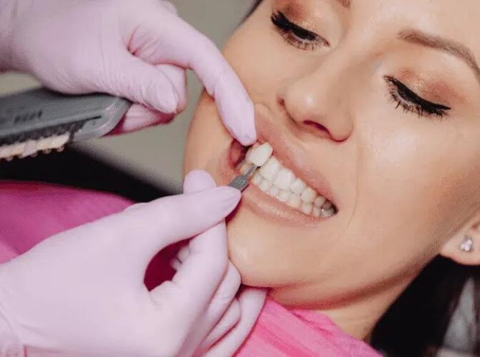 What to Do if You Have Intense Pain After Dental Veneers?