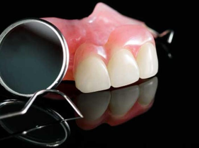 Restore Your Smile with Full and Partial Dentures