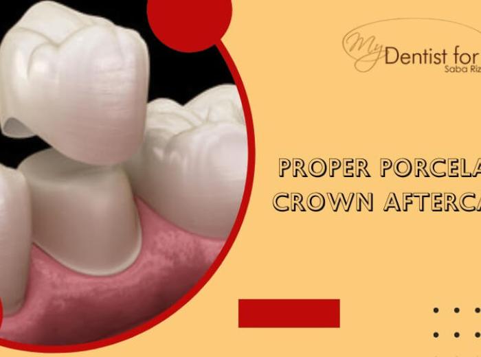 Essential Tips For Proper Porcelain Crown Aftercare
