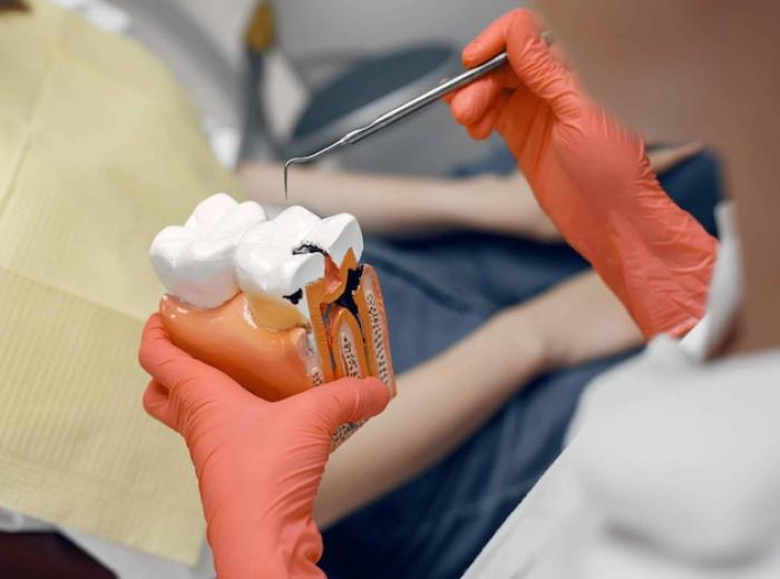 Root Canal Aftercare: A Full Guide For Proper Recovery