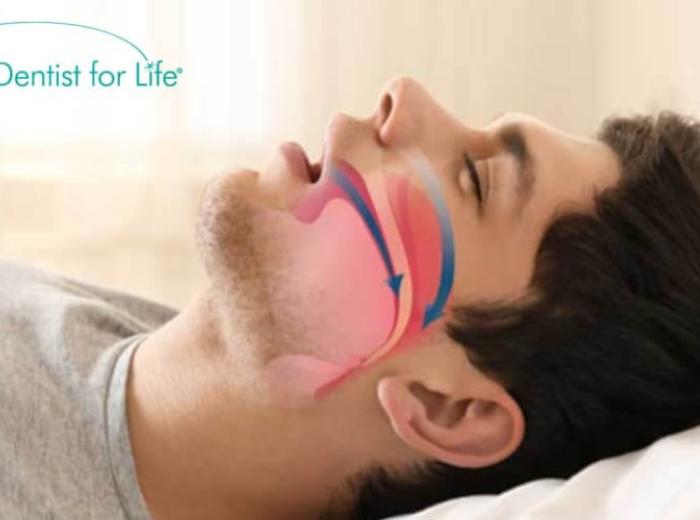 6 Remedies To Deal With The Problem Of Sleep Apnea