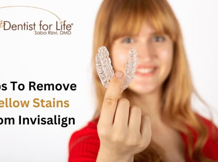 4 Tips To Remove Yellow Stains From Invisalign