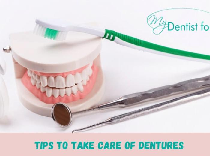 Find Out The Tips To Take Care Of Dentures
