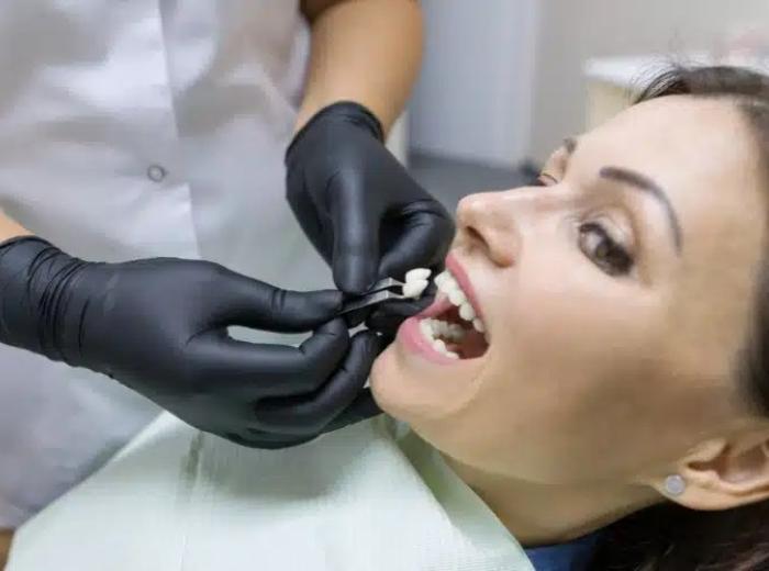 Exploring Tooth Replacement: Options & Tips for Success