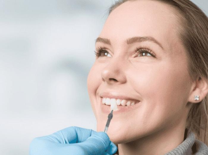 Is Your Veneer Loose or Fallen Off? Here’s What to Do Next