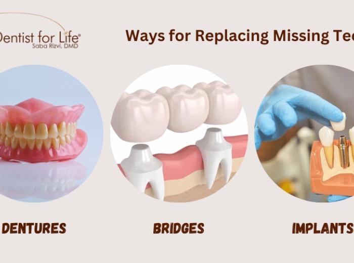 4 Ways for Replacing Missing Teeth: A Guide to Your Options