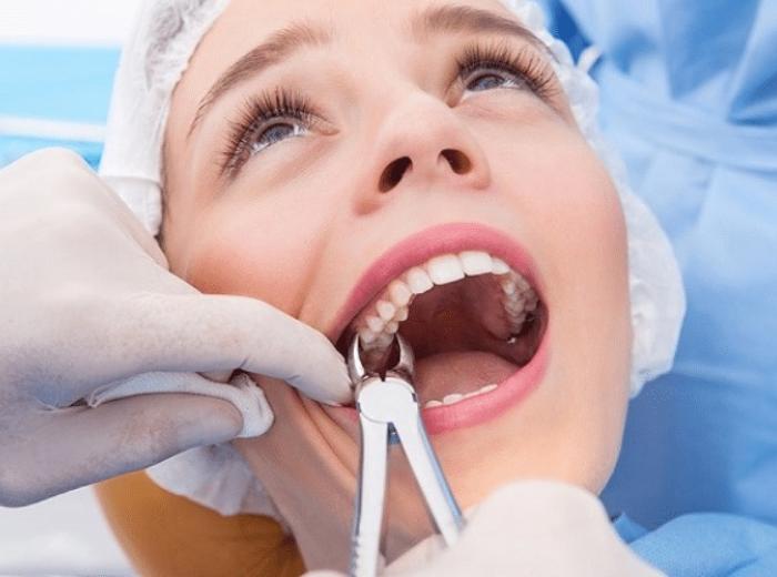 The Common Signs of Impacted Wisdom Teeth and What to Do About Them