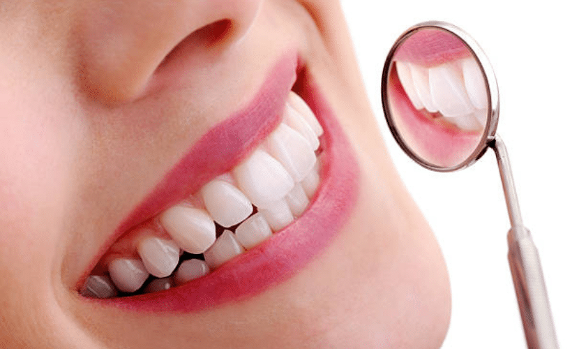 KÖR® Teeth Whitening