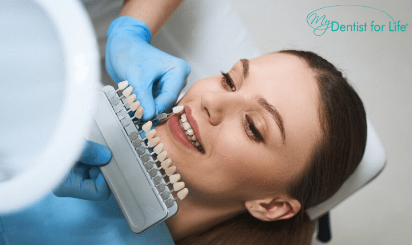 Dental Veneers Plantation