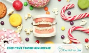Food Items Causing Gum Disease