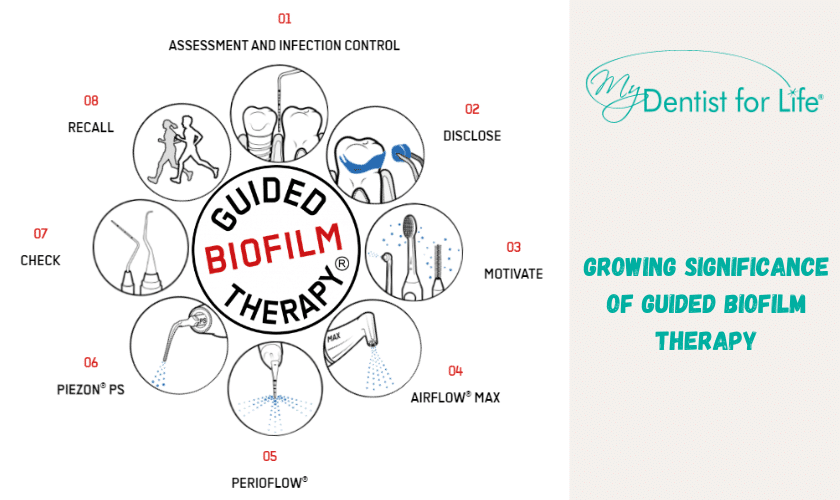 Growing Significance of Guided Biofilm Therapy (1)