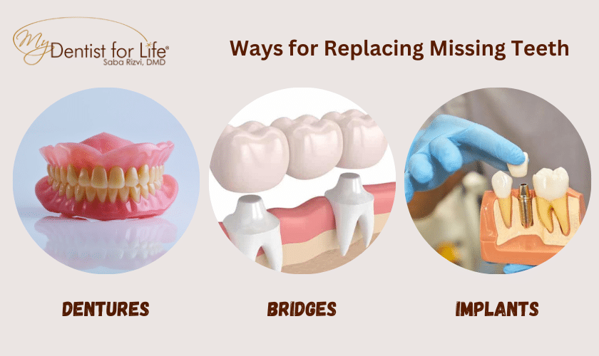 Ways for Replacing Missing Teeth