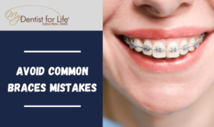 Avoid Common Braces Mistakes