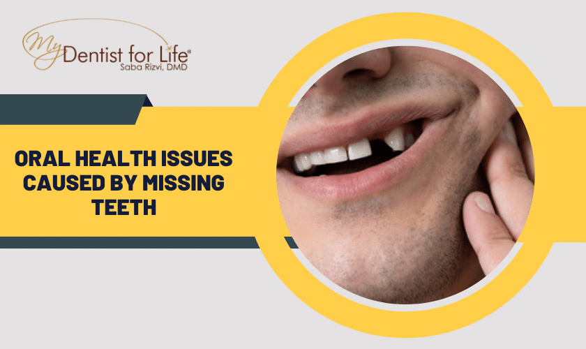 Oral Health Issues Caused by Missing Teeth