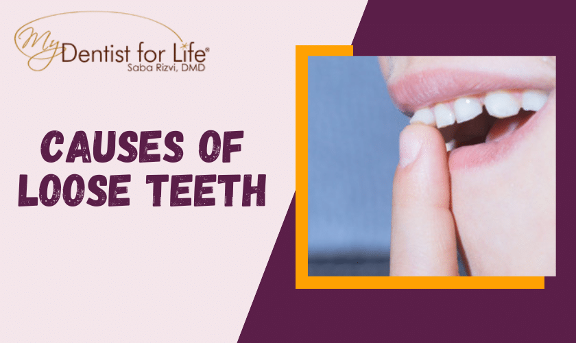 Root Causes of Loose Teeth