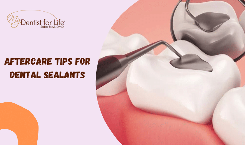 Aftercare Tips For Dental Sealants