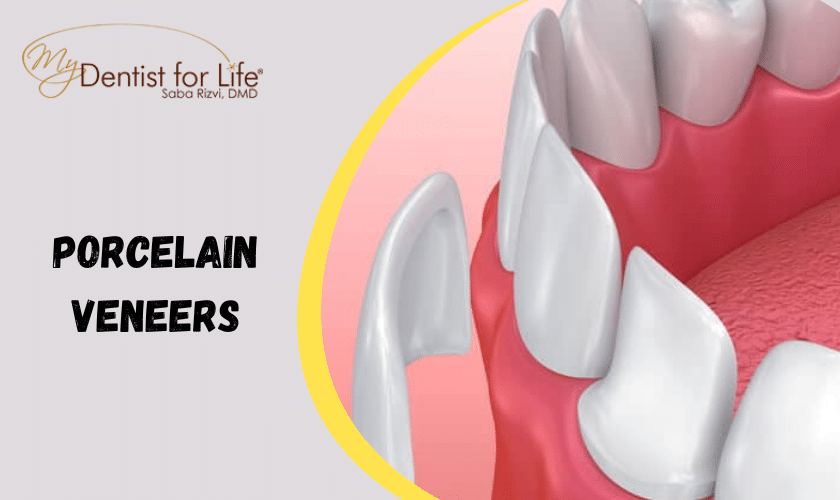 Signs It's Finally Time For Porcelain Veneers