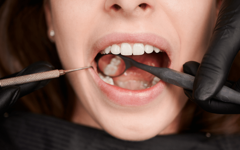 Dental Health