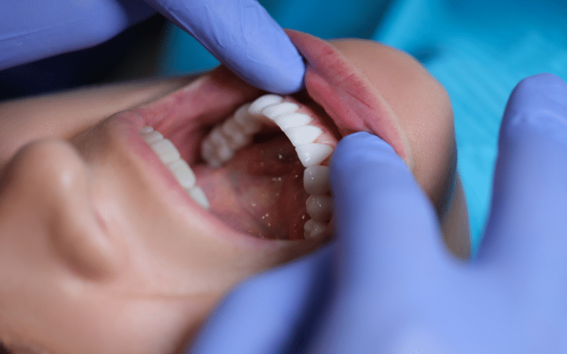 Oral Surgery