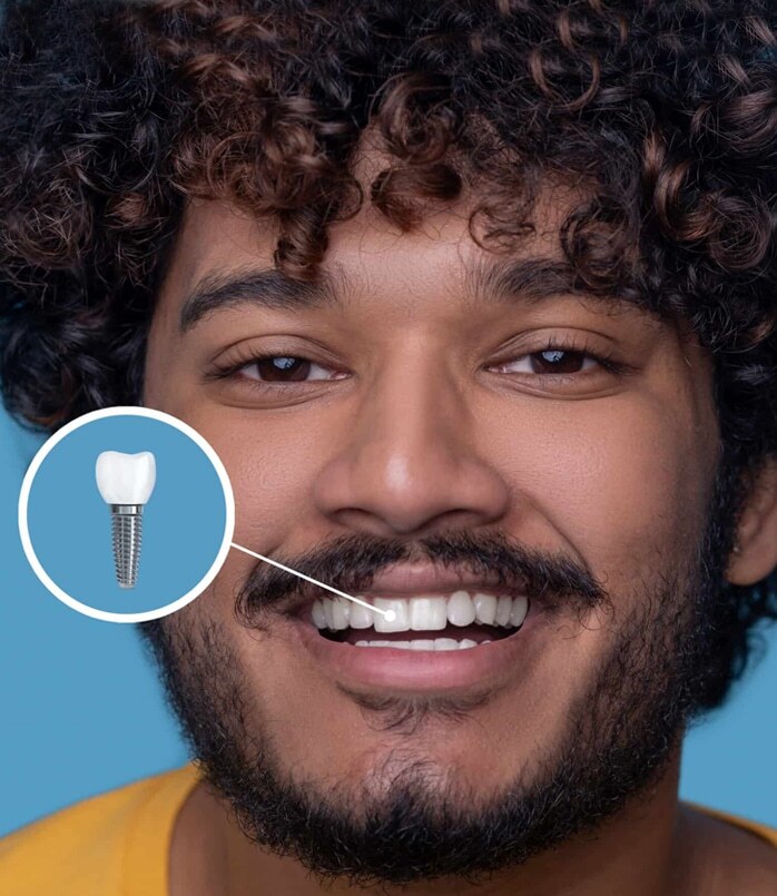 Man smiling showing healthy teeth with dental implant diagram highlighted in circle.