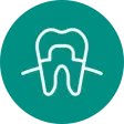 Porcelain Veneers