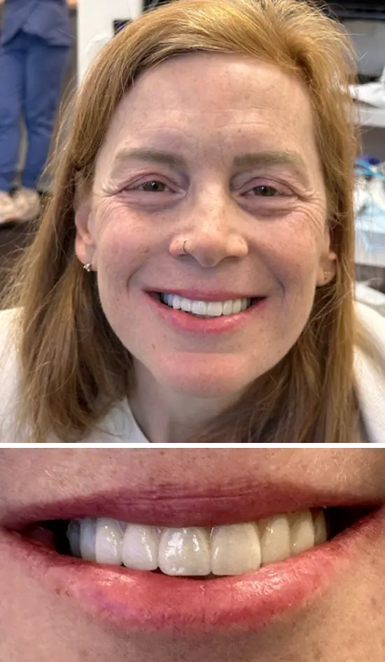 After cosmetic dental treatment showing the patient's restored and enhanced smile.
