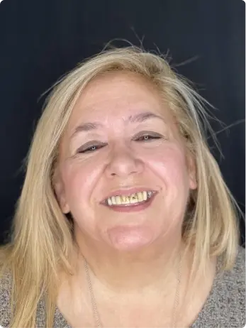 Smiling woman displaying results from Airflow Technology guided biofilm therapy treatment.