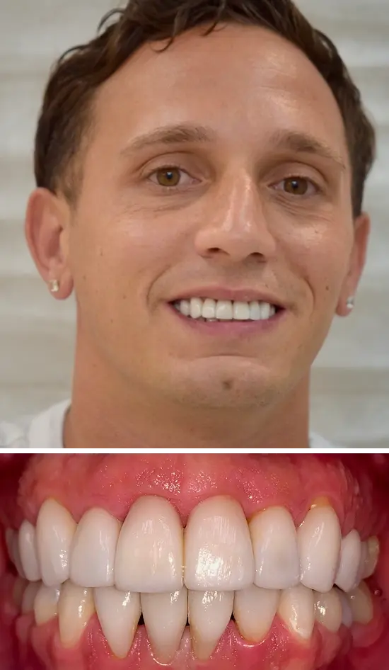 After cosmetic dental treatment showing the patient's restored and enhanced smile.